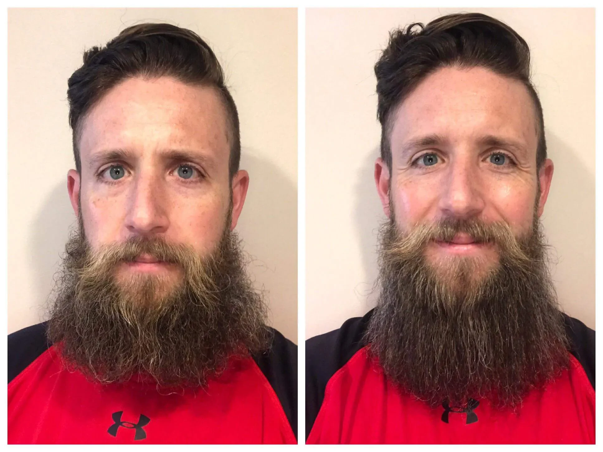 before and after beard dye 2024